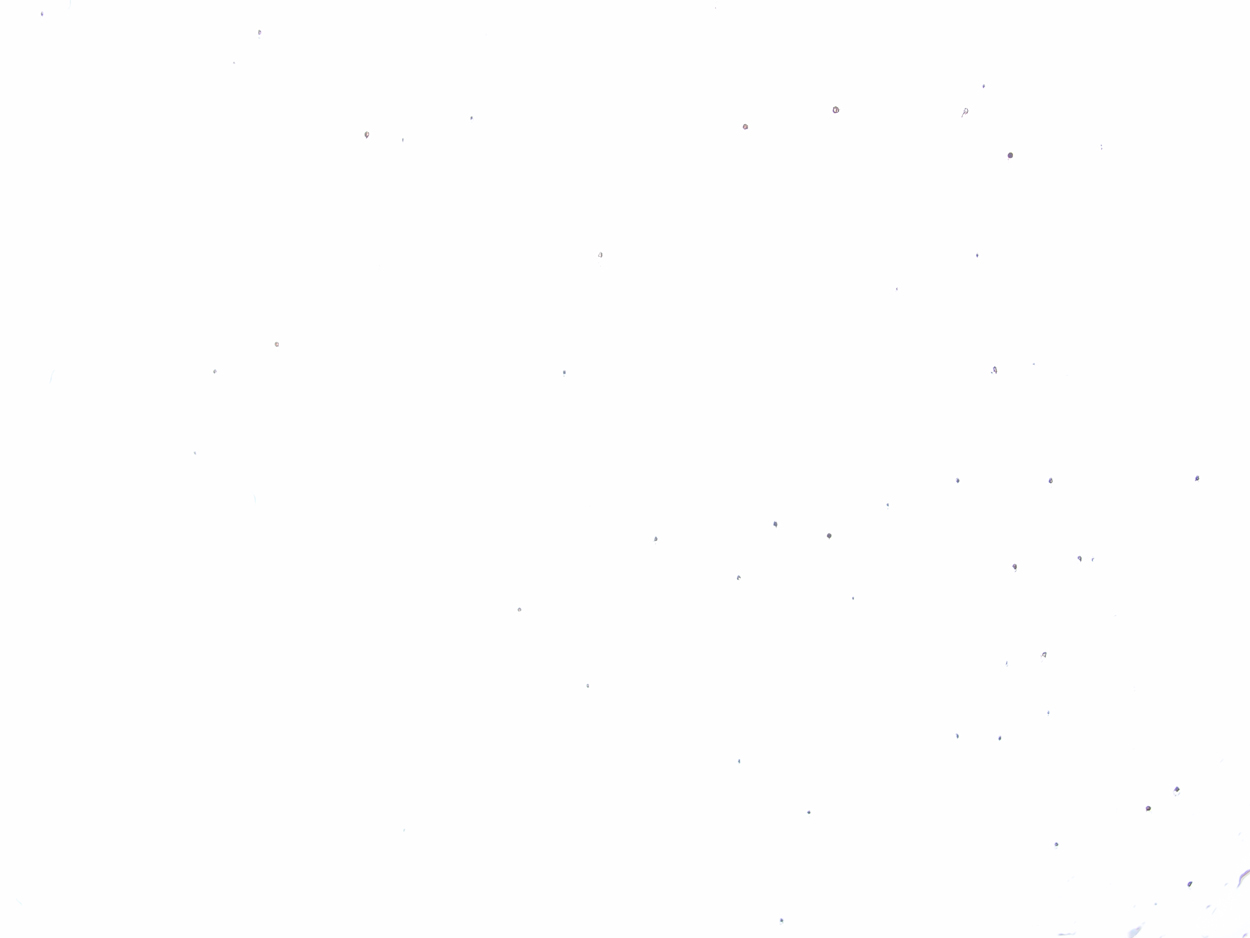 temporäres rauschpartikel Studio Weserstr. 54